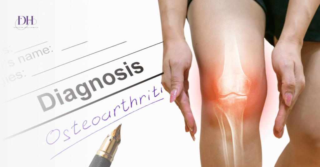 Osteoarthritis Breakthrough 2025: UC-MSC Therapy Works